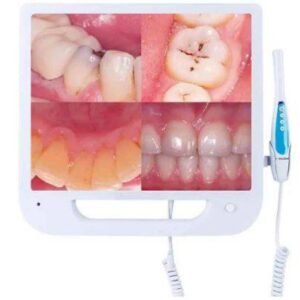 Intraoral camera